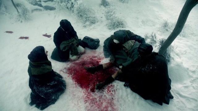 3 серия, 1 сезона, сериала Записки юного врача (2012)