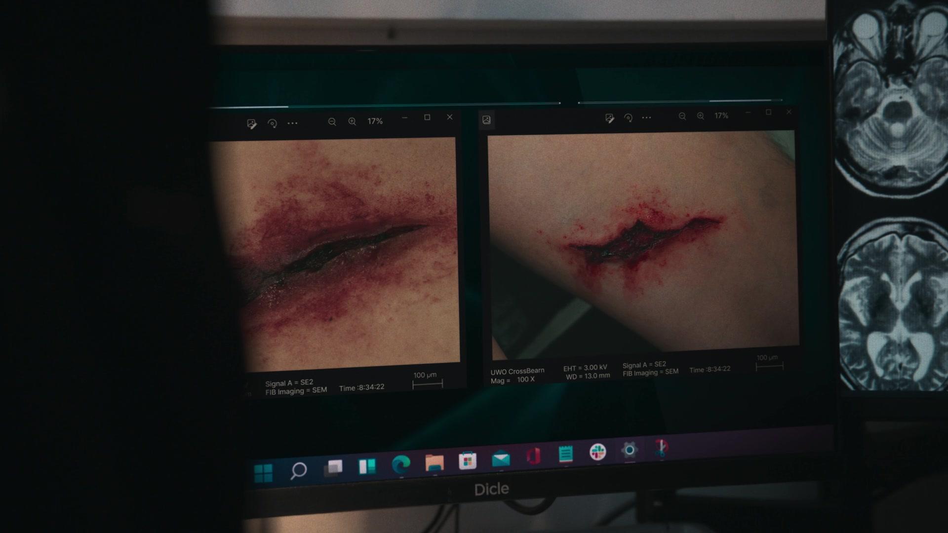 Сериал Паразит: Серый (2024) 1 сезон 6 эпизод