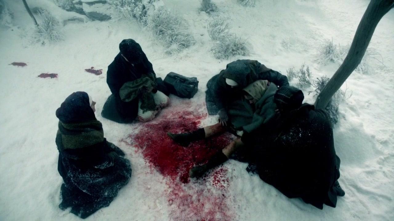 Сериал Записки юного врача (2012) 1 сезон 3 эпизод